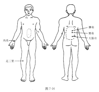 砭石治療慢性胃炎的方法