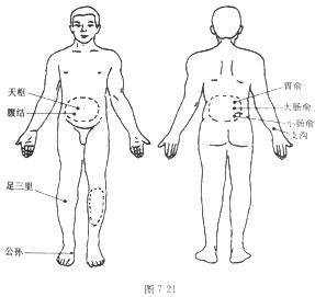 砭石調理便秘