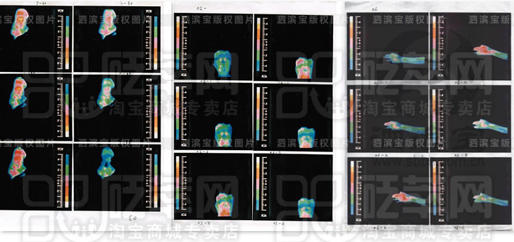 砭石學堂：泗濱砭石的作用和功效圖8