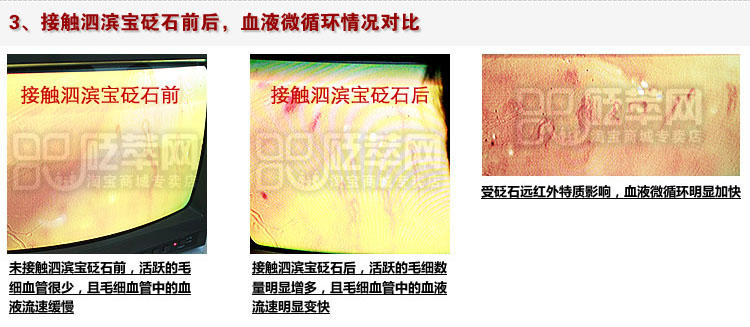 砭石學堂：泗濱砭石對人體甲襞微循環血流速度影響的定量檢測圖12