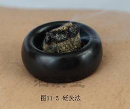 砭灸法