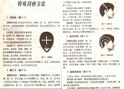 刮痧手法
