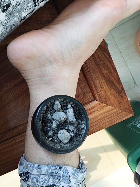 使用砭石灸盒的五點注意事項,趕緊看看!