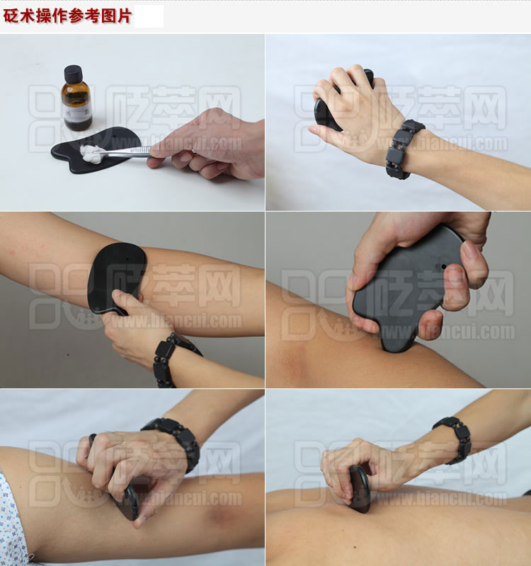 砭石什么時(shí)候開始有的,其對(duì)人體有什么好處?